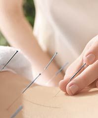 Acupuncture – Holly Goguen L.Ac. Acupuncture